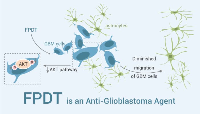 FPDT is AN Anti Cancer Agent 2022 0630 - FPDT is an anti-glioblastoma agent and shows anti-glioblastoma activity by AKT pathway.
